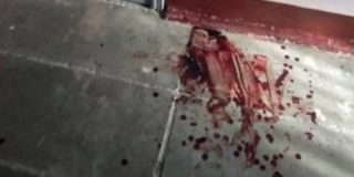 На Кутякова группа агрессоров жестоко избила и ограбила пожилого коменданта дома На Кутякова группа агрессоров жестоко избила и ограбила пожилого коменданта дома