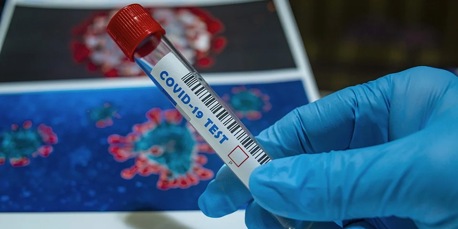 Смертность от коронавируса в России остается одной из самых низких в мире