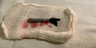 В Саратове трехлетняя девочка едва не погибла во время рисования кисточкой В Саратове трехлетняя девочка едва не погибла во время рисования кисточкой