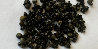 В Балакове врачи достали из желчного пузыря пациентки россыпь камней В Балакове врачи достали из желчного пузыря пациентки россыпь камней