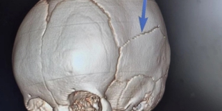 Малыша доставили санавиацией в Саратов после «несерьезного» падения с кроватки Малыша доставили санавиацией в Саратов после «несерьезного» падения с кроватки