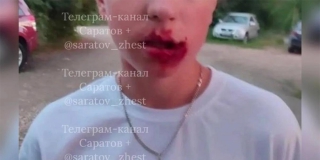 В Шумейке мужчина избил 14-летнего подростка кулаками и ногами. Начата проверка В Шумейке мужчина избил 14-летнего подростка кулаками и ногами. Начата проверка