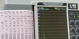 В Красноармейской больнице болезни сердца выявляют на новом аппарате ЭКГ с ИИ В Красноармейской больнице болезни сердца выявляют на новом аппарате ЭКГ с ИИ